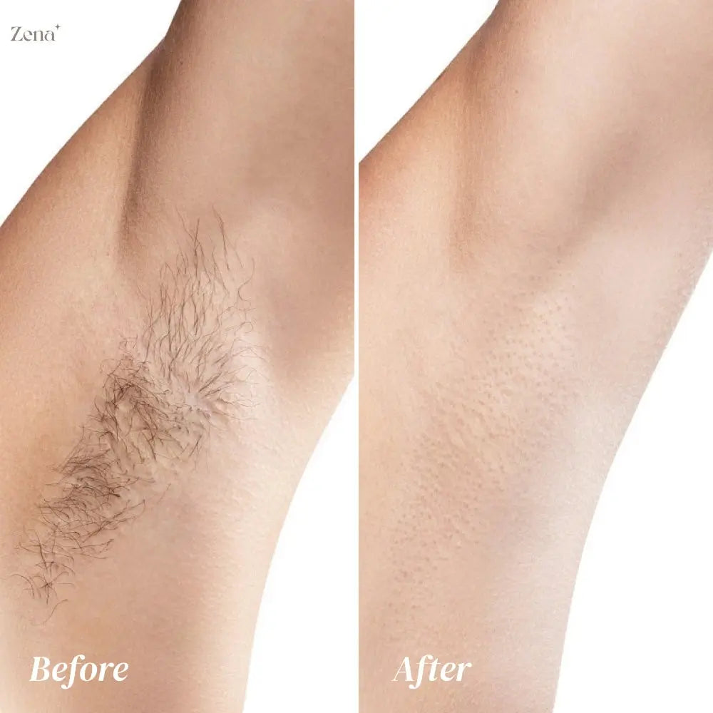 Painless Hair Removal Cream for Body