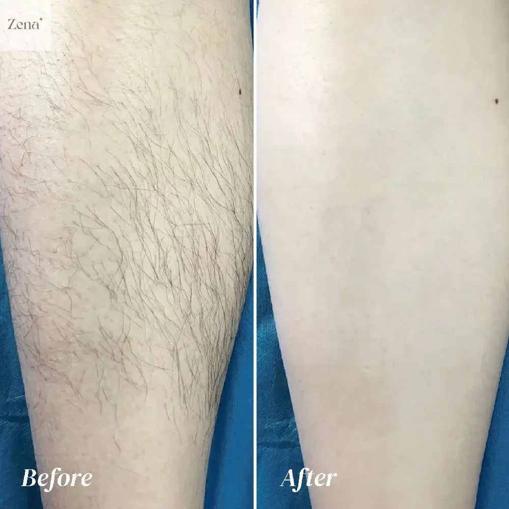 Painless Hair Removal Cream for Body